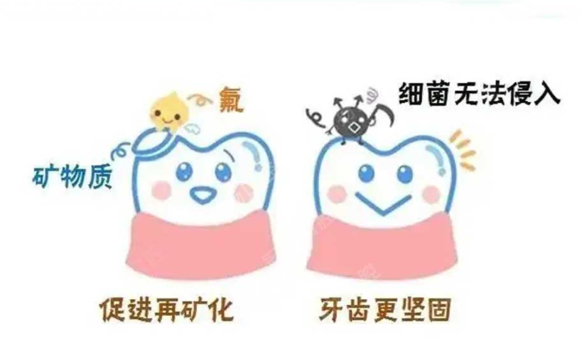 02 孩子3歲多可以開(kāi)始涂氟嗎？.png