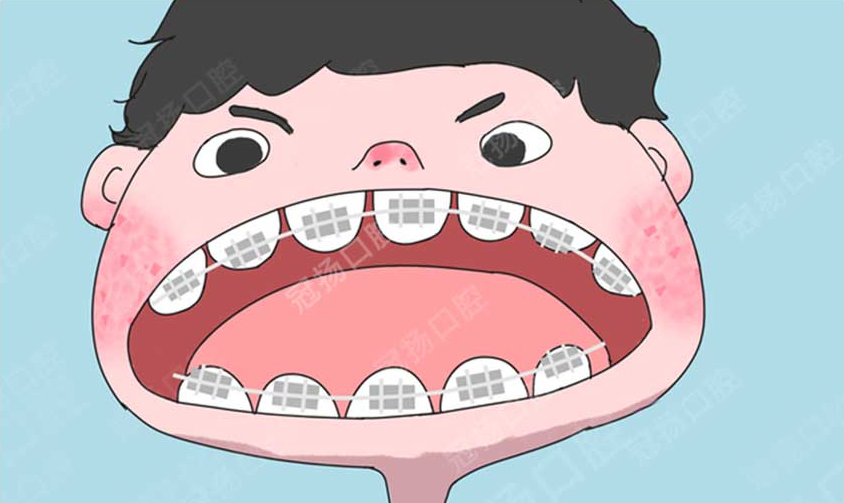 02 孩子錯(cuò)頜畸形為啥要早干預(yù)？.png