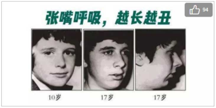 03 長期口呼吸真的會變“丑”嗎？.png