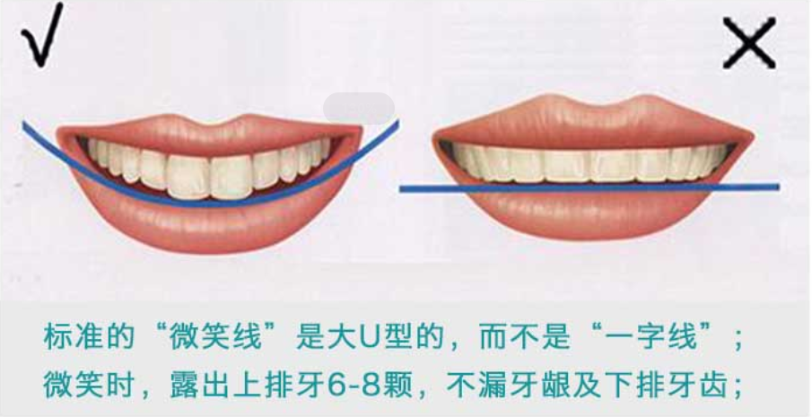 06 牙齒整齊的人為啥還做矯正？.png